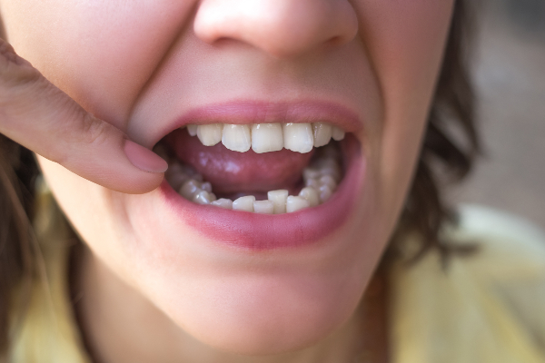 Concept per denti storti - Dr. Chiara Piccioni