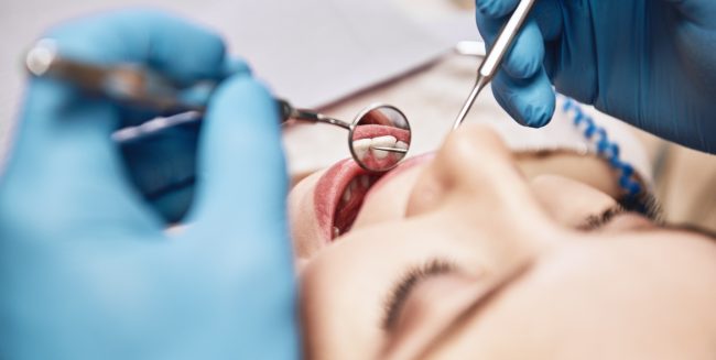 Trattamenti da eseguire prima di mettere l’apparecchio: detartrasi - Chiara Piccioni